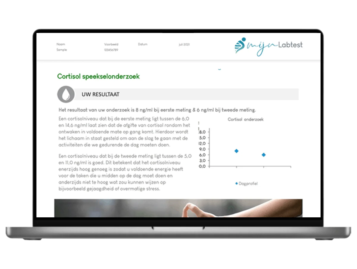 Voorbeeld van de cortisol test uitslag op een laptop