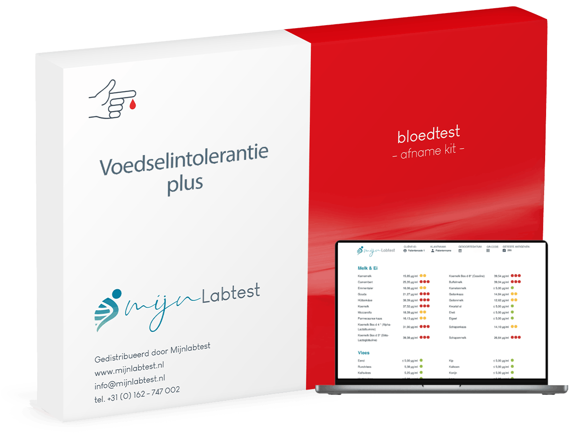 Voedsel intolerantie Test plus